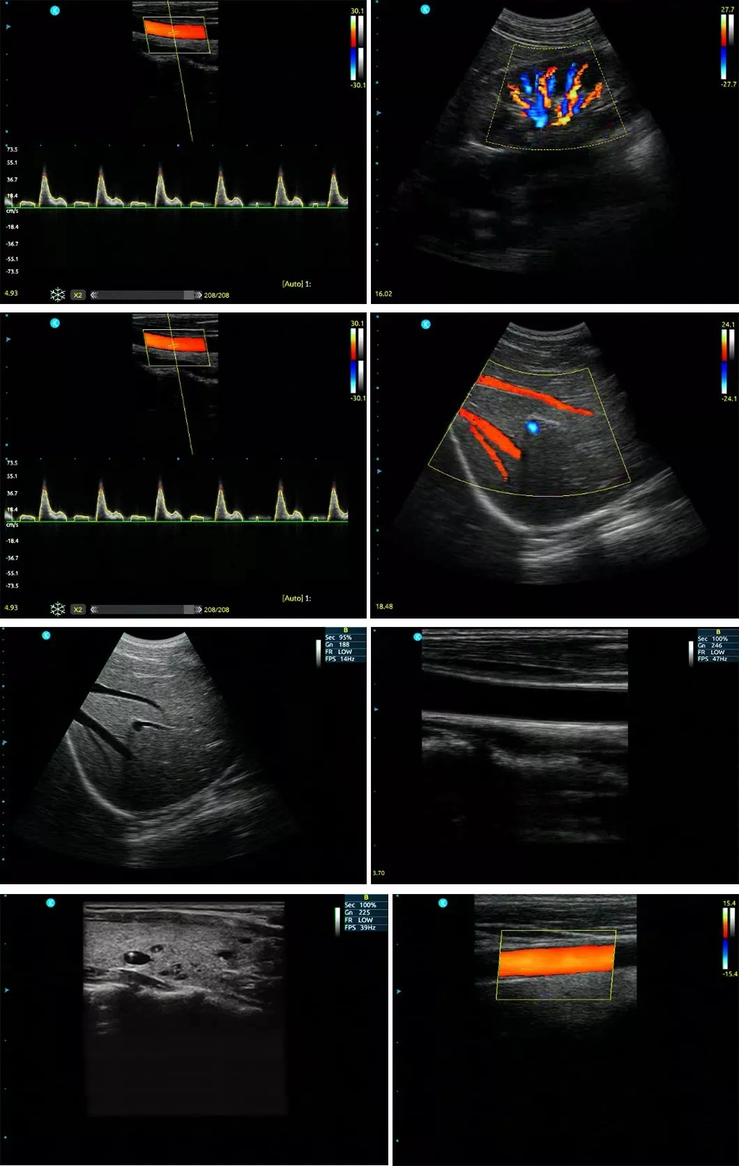 Hand-Carried Ultrasonic Machine Portable Color Dopler Ultrasound Diagnostic Scanner