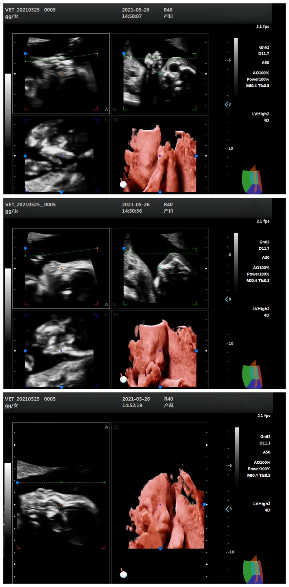 4D 5D Color Ultrasonic Diagnostic Apparatus, Portable Color Doppler Ultrasound Scanner Mslcu64